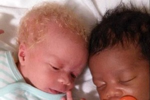 В 2016 году родились удивительные близнецы - темнокожий мальчик и девочка-альбинос: как они выглядят сейчас