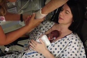 Как выглядит новорожденная, которая весила всего 340 грамм, спустя 4 года