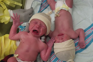 Новорожденные близнецы плакали, не переставая, пока их снова не положили рядом: трогательное видео
