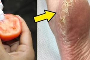 Знакомая-косметолог показала SOS-трюк от трещин на пятках: нужен помидор