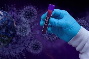 Исследователи определили, какого цвета коронавирус